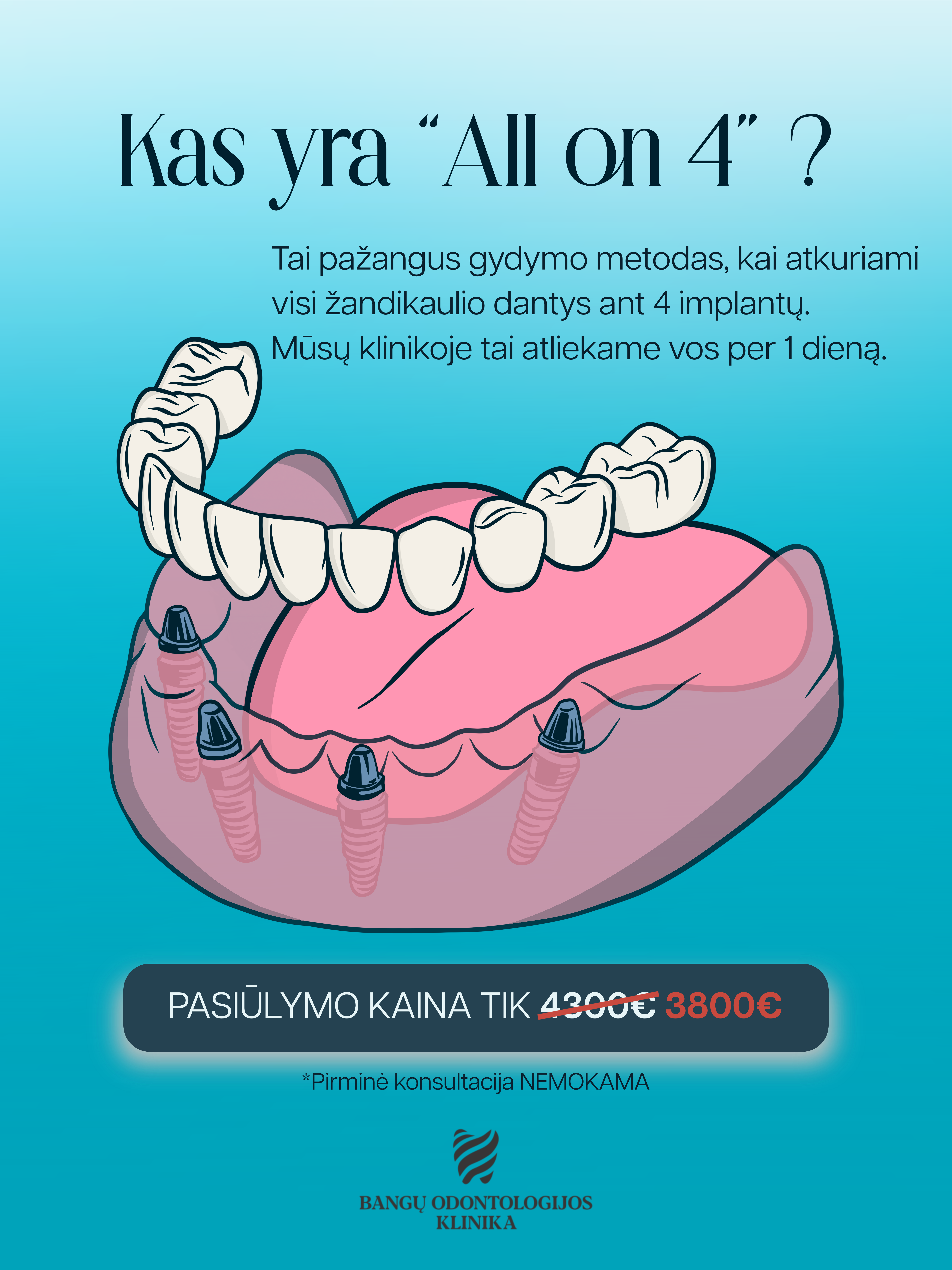 Atkuriame visus žandikaulio dantis ant 4 implantų – vos per 1 dieną!